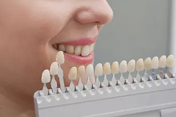 dental-veneers-richardson-texas