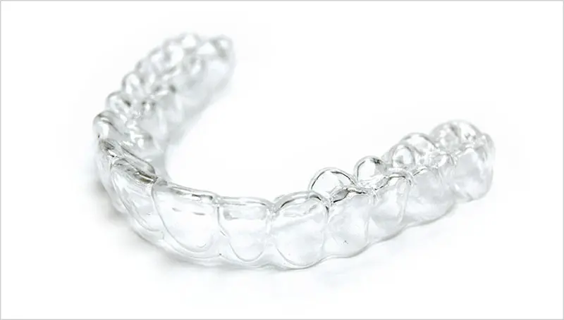 Invisalign tray | Richardson Family Dentistry | Richardson TX